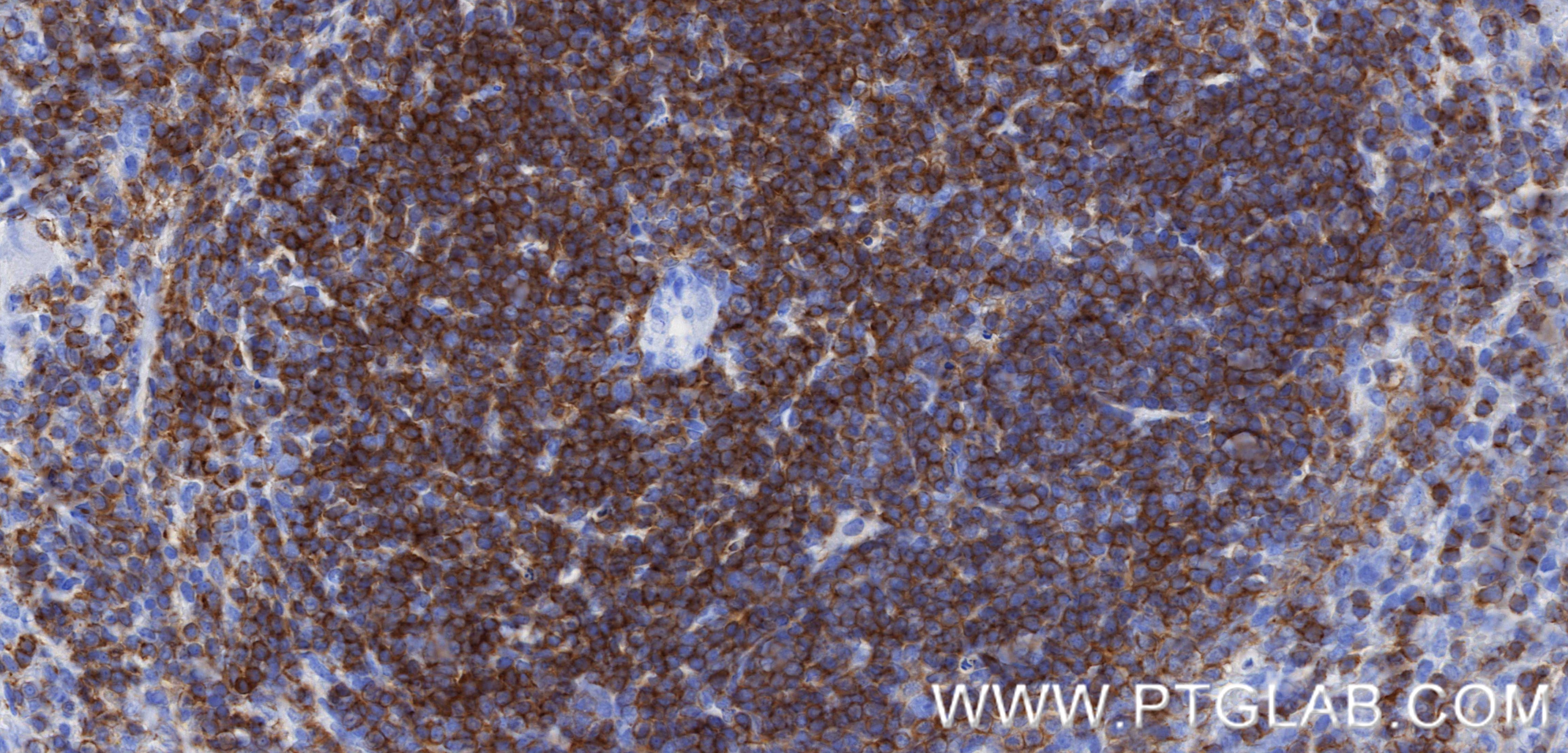 Immunohistochemistry (IHC) staining of mouse spleen tissue using CD2 Recombinant monoclonal antibody (84360-4-RR)