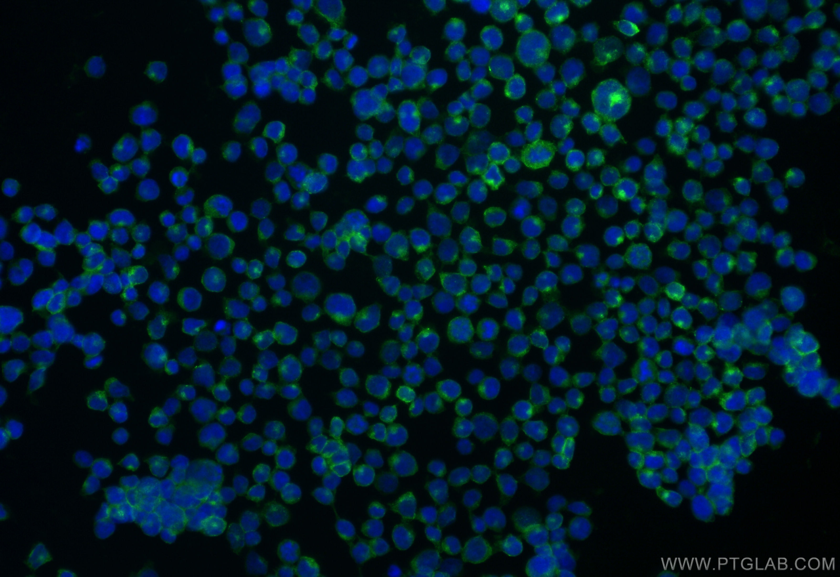 Immunofluorescence (IF) / fluorescent staining of Jurkat cells using CoraLite® Plus 488-conjugated CD2 Recombinant anti (CL488-84108-3)