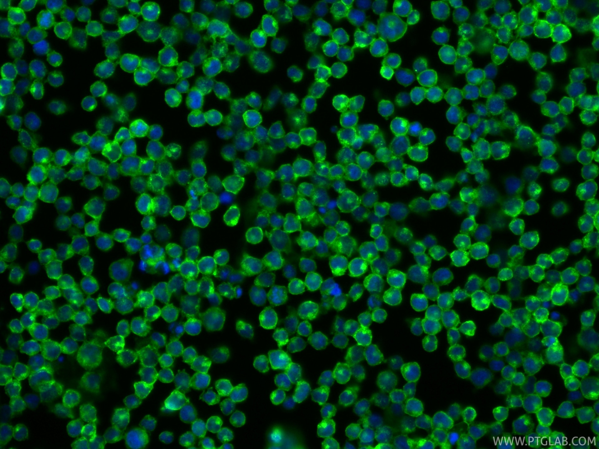 Immunofluorescence (IF) / fluorescent staining of Jurkat cells using CoraLite® Plus 488-conjugated CD2 Recombinant mono (CL488-84108-5)