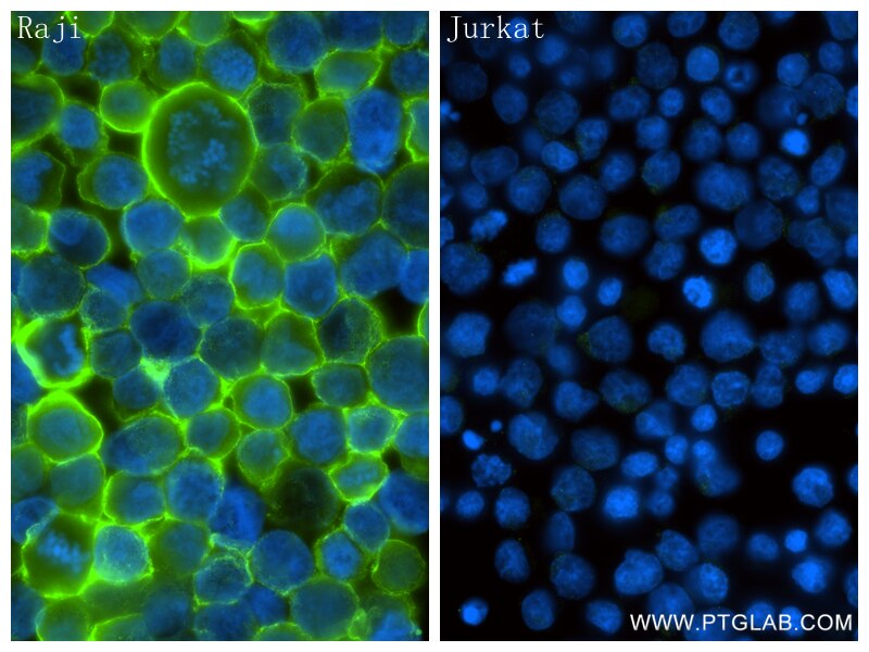 Immunofluorescence (IF) / fluorescent staining of Jurkat cells using CD20 Recombinant monoclonal antibody (86480-1-RR)