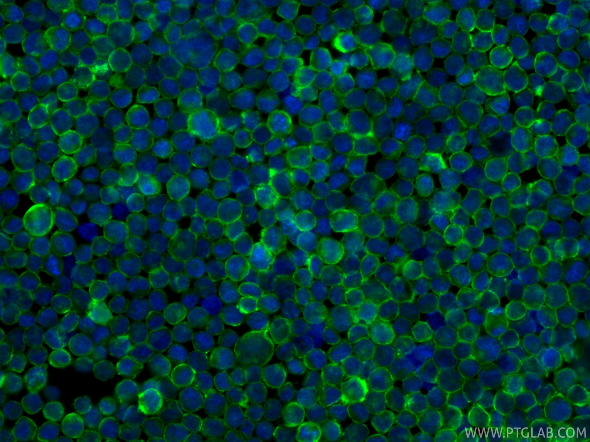 Immunofluorescence (IF) / fluorescent staining of Raji cells using CoraLite® Plus 488-conjugated CD20 Recombinant mon (CL488-86480)