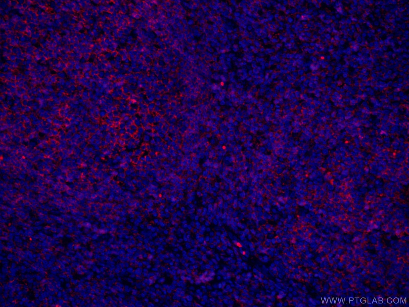 Immunofluorescence (IF) / fluorescent staining of human tonsillitis tissue using CoraLite® Plus 647-conjugated CD20 Monoclonal anti (CL647-60271)