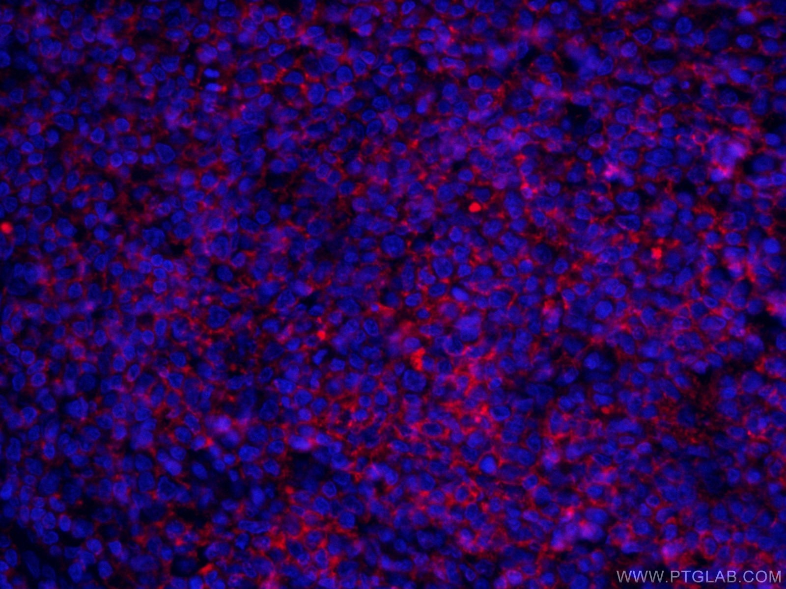 Immunofluorescence (IF) / fluorescent staining of human tonsillitis tissue using CoraLite® Plus 647-conjugated CD20 Monoclonal anti (CL647-60271)