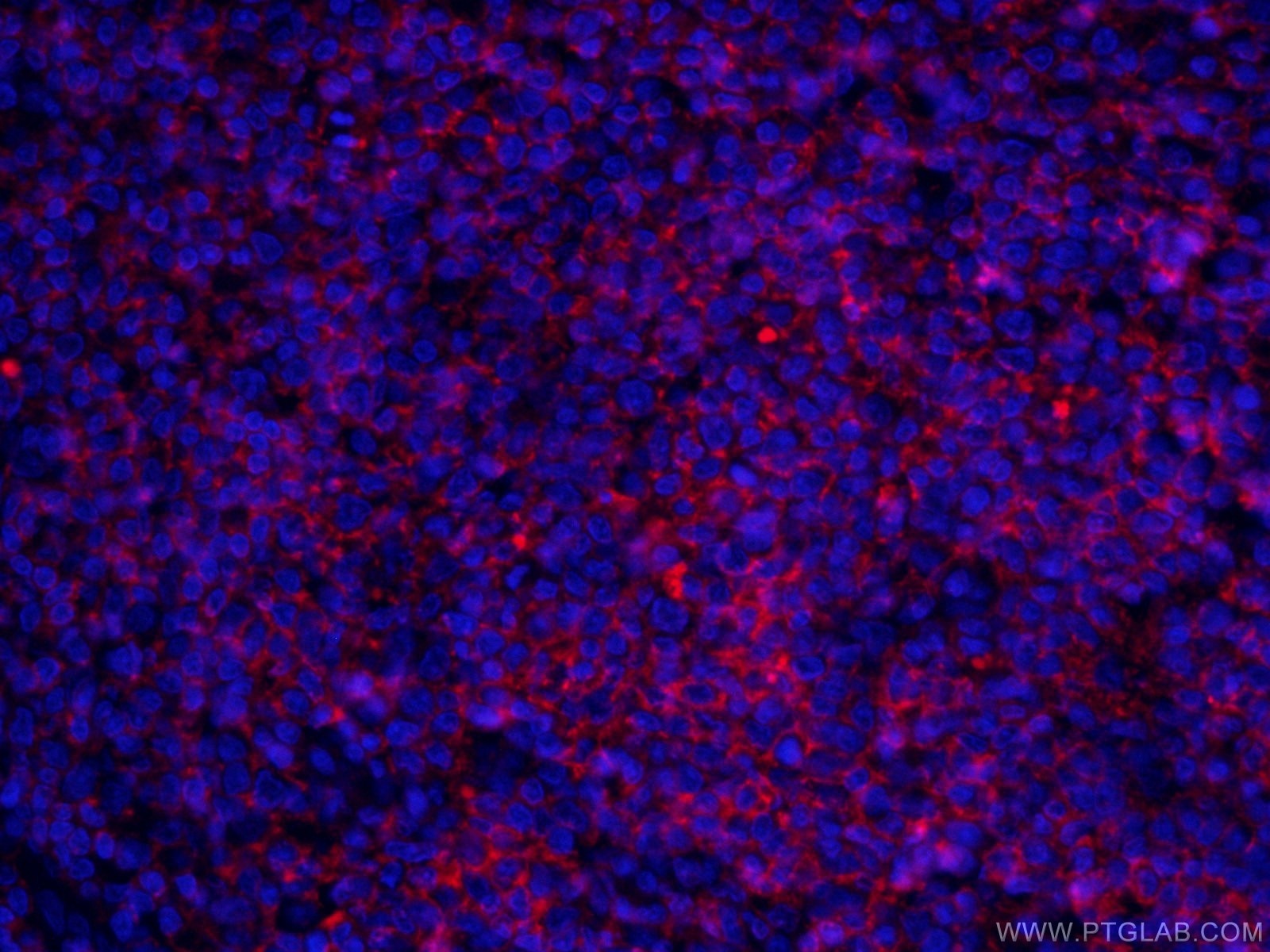 IF Staining of human tonsillitis using CL647-60271