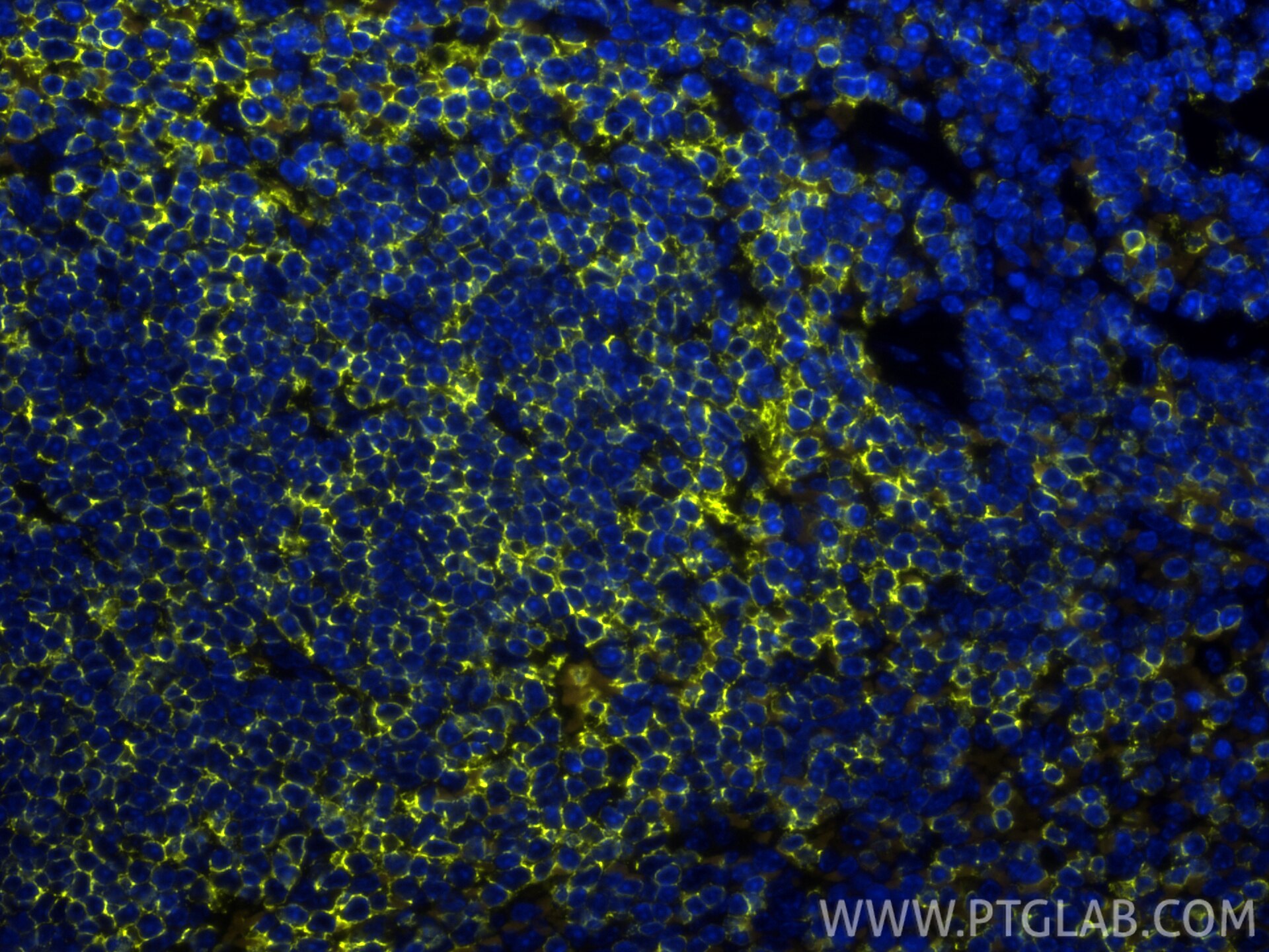 IF Staining of mouse spleen using PE-31909 Immunofluorescence (IF) / fluorescent staining of mouse spleen tissue using PE-conjugated CD20 Polyclonal antibody (PE-31909)