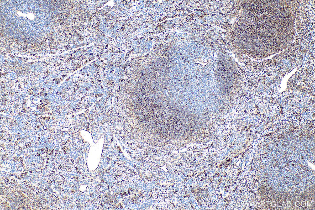 Immunohistochemistry (IHC) staining of mouse spleen tissue using CD200 Polyclonal antibody (31444-1-AP)
