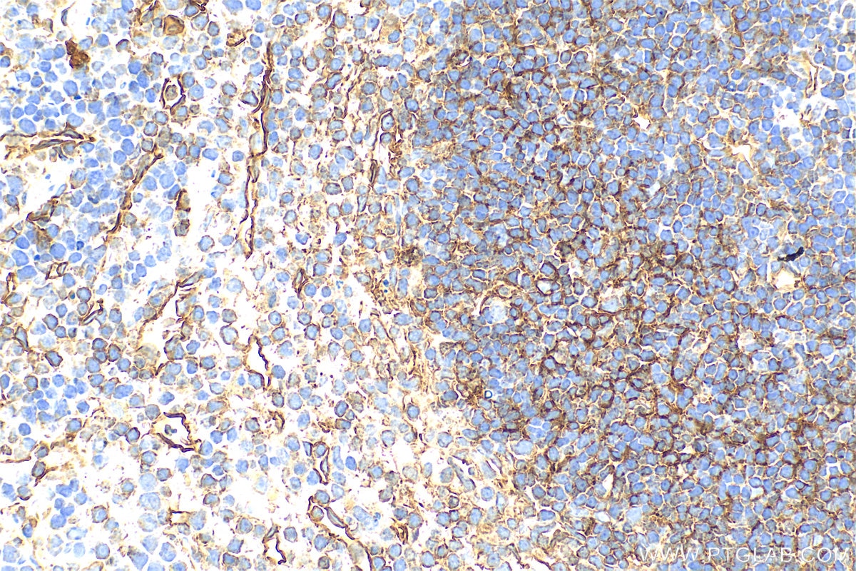 Immunohistochemistry (IHC) staining of mouse spleen tissue using CD200 Polyclonal antibody (31444-1-AP)