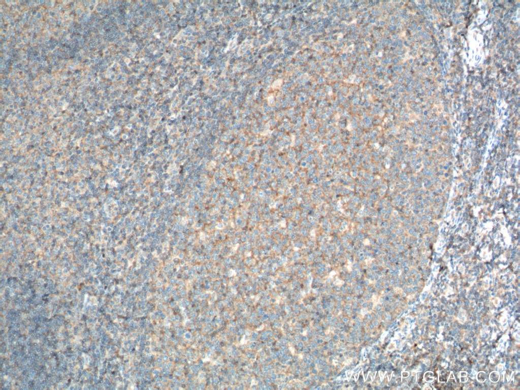 Immunohistochemistry (IHC) staining of human tonsillitis tissue using CD200 Monoclonal antibody (66282-1-Ig)