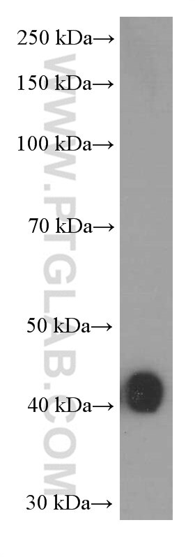 WB analysis of fetal human brain using 66282-1-Ig