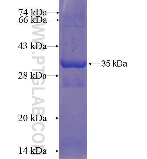 CD200 fusion protein Ag5045 SDS-PAGE