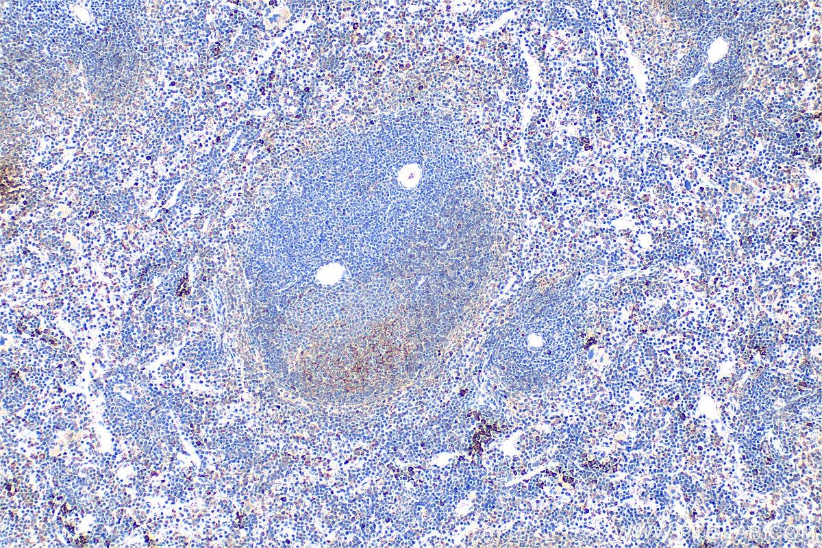 Immunohistochemical analysis of paraffin-embedded mouse spleen tissue slide using 34012-1-AP (CD200R1L antibody) at dilution of 1:400 (under 10x lens). Heat mediated antigen retrieval with Tris-EDTA buffer (pH 9.0). Immunohistochemistry (IHC) staining of mouse spleen tissue using CD200R1L Polyclonal antibody (34012-1-AP)
