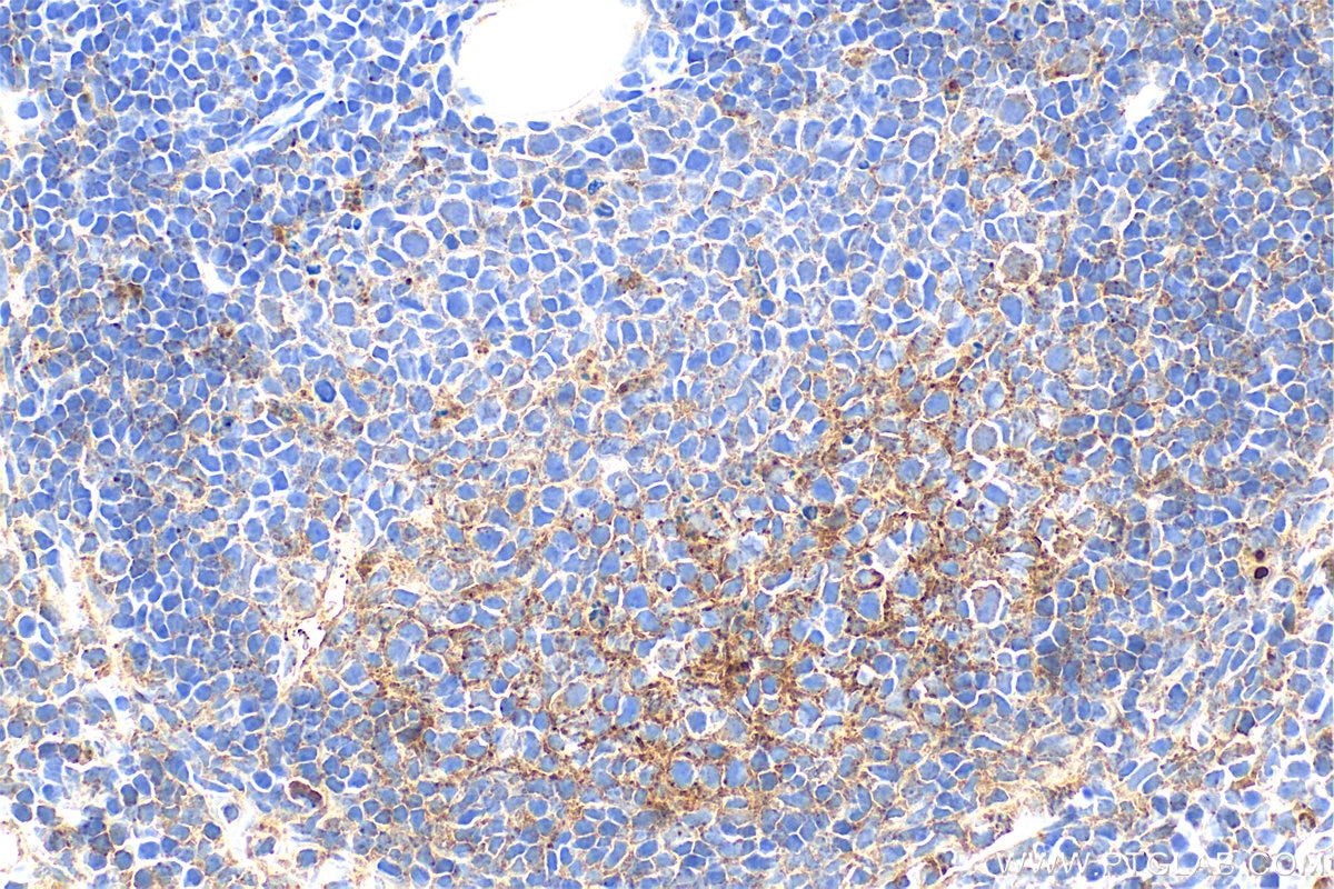 Immunohistochemical analysis of paraffin-embedded mouse spleen tissue slide using 34012-1-AP (CD200R1L antibody) at dilution of 1:400 (under 40x lens). Heat mediated antigen retrieval with Tris-EDTA buffer (pH 9.0). Immunohistochemistry (IHC) staining of mouse spleen tissue using CD200R1L Polyclonal antibody (34012-1-AP)