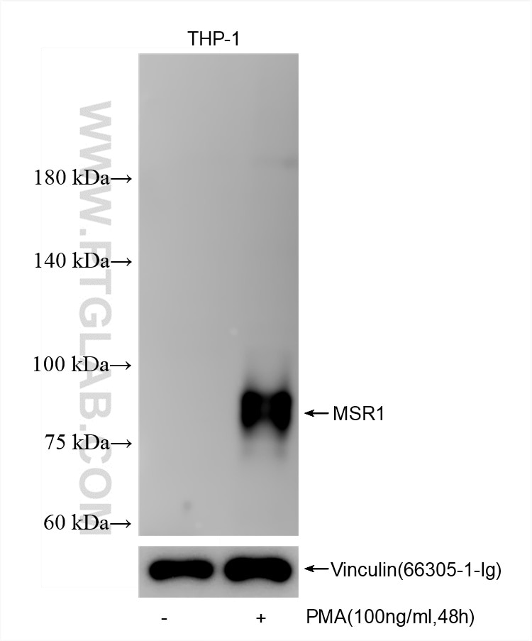 CD204