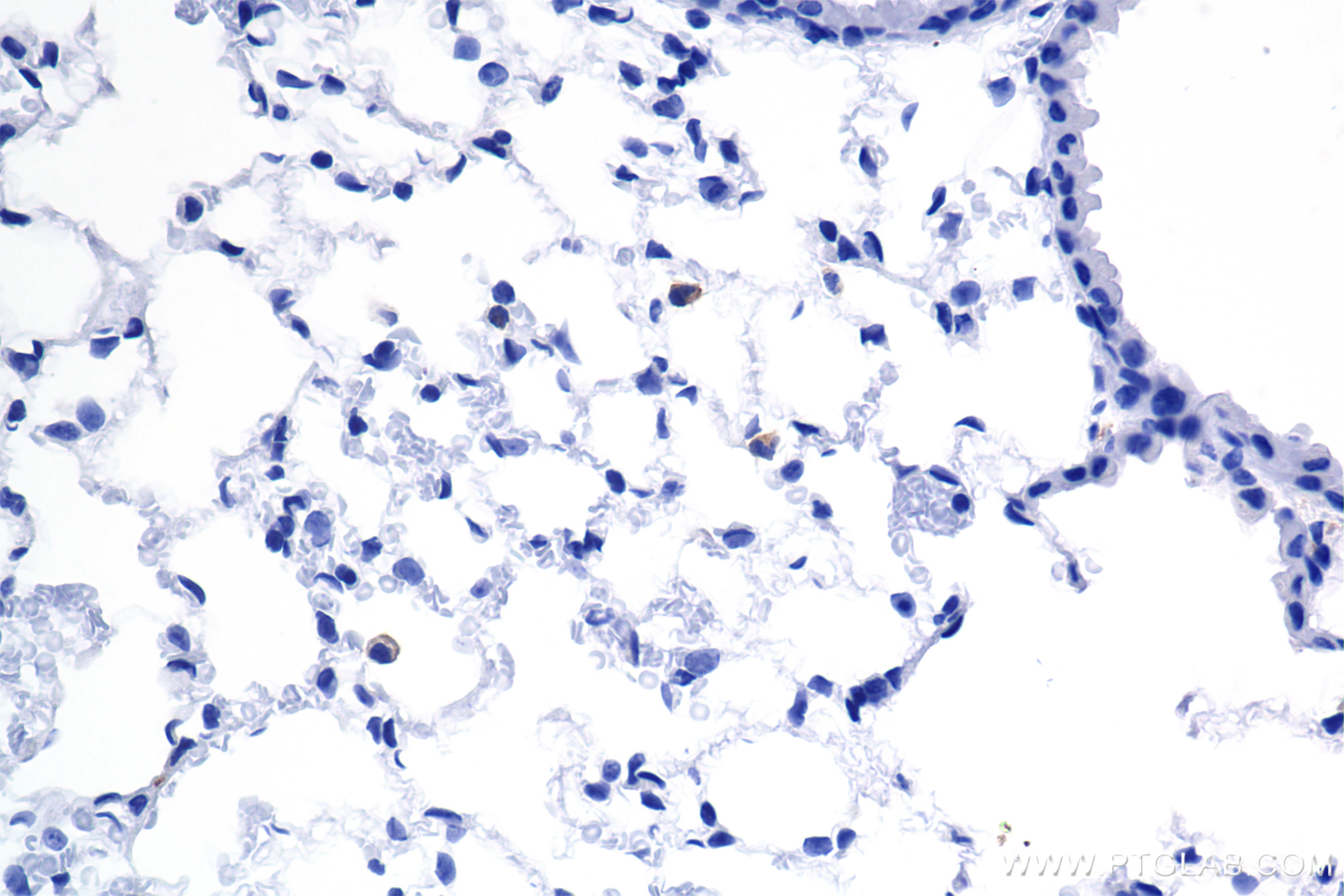 Immunohistochemistry (IHC) staining of mouse lung tissue using CD204 Recombinant monoclonal antibody (86552-3-RR)