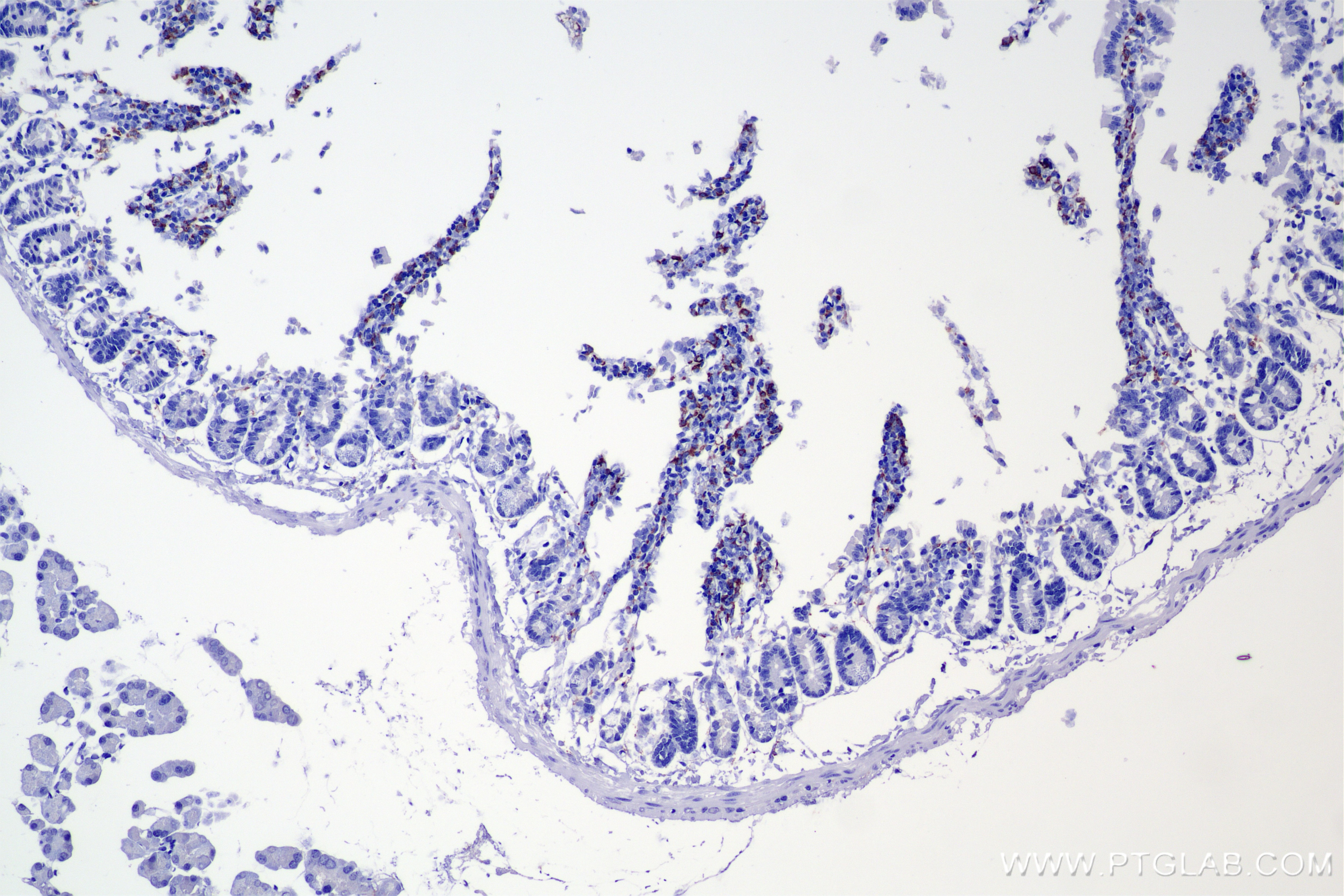 Immunohistochemistry (IHC) staining of mouse small intestine tissue using CD204 Recombinant monoclonal antibody (86552-3-RR)