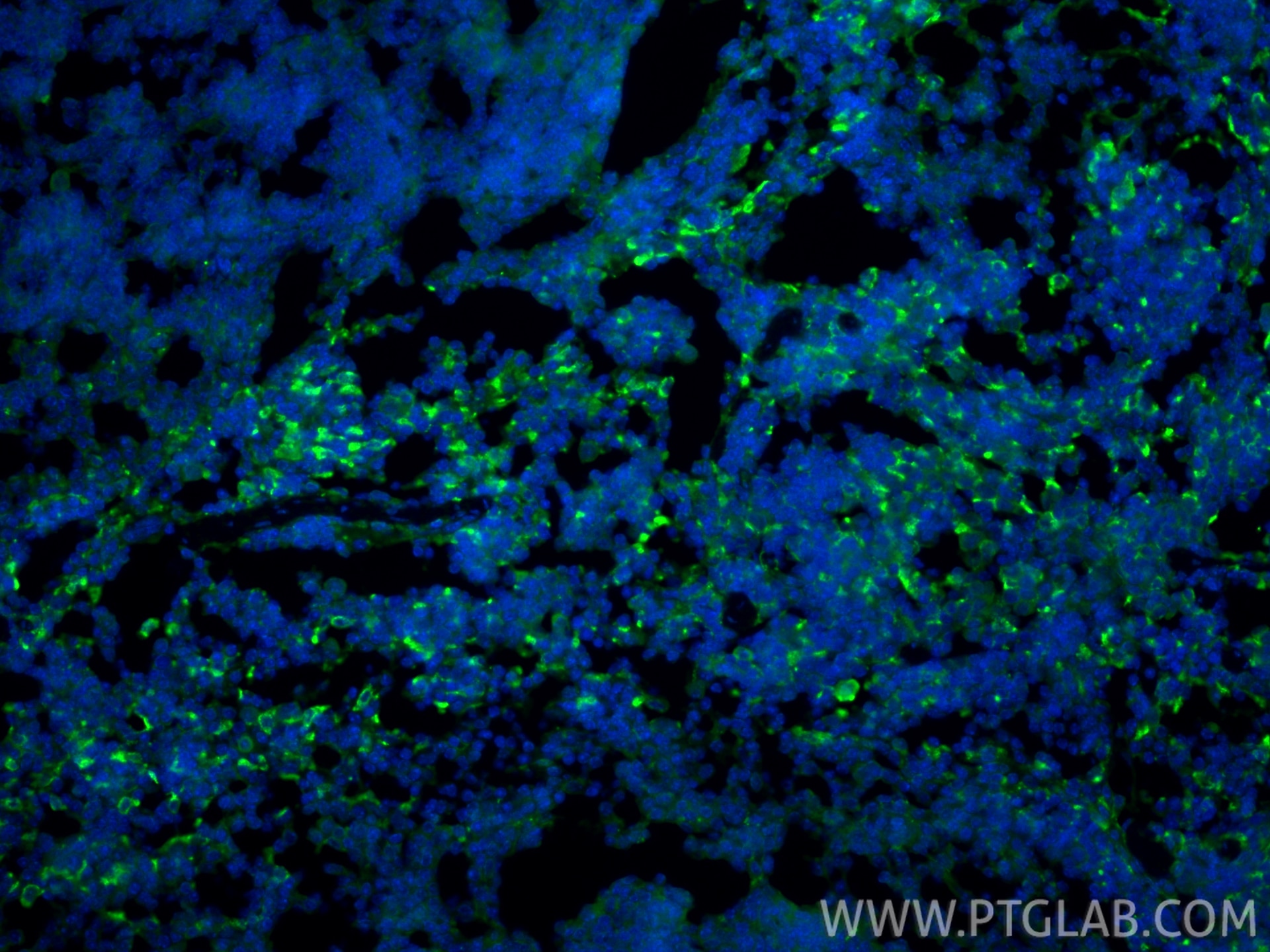 IF Staining of mouse spleen using 32647-1-AP Immunofluorescence (IF) / fluorescent staining of mouse spleen tissue using CD206 Polyclonal antibody (32647-1-AP)