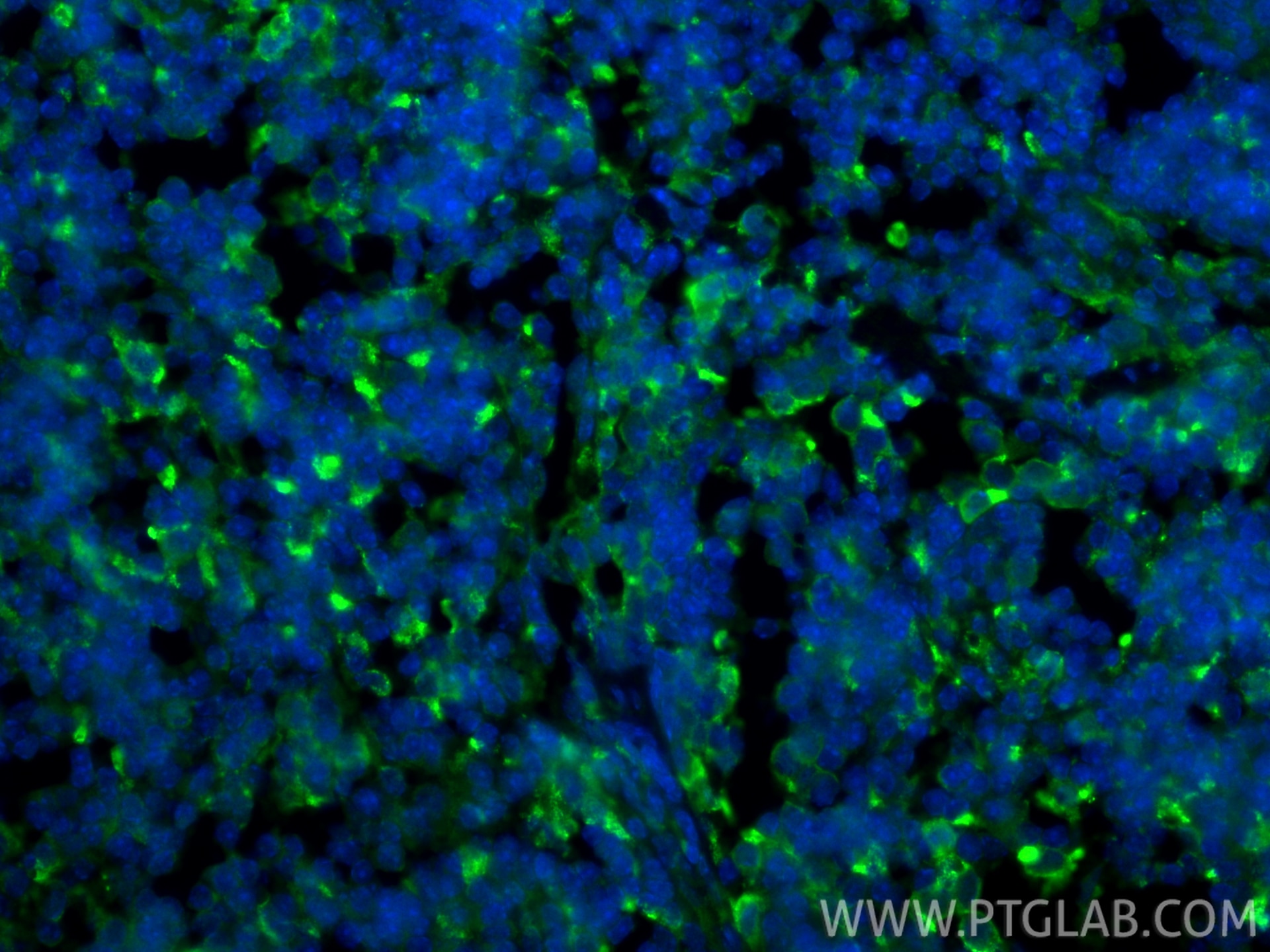 IF Staining of mouse spleen using 32647-1-AP Immunofluorescence (IF) / fluorescent staining of mouse spleen tissue using CD206 Polyclonal antibody (32647-1-AP)