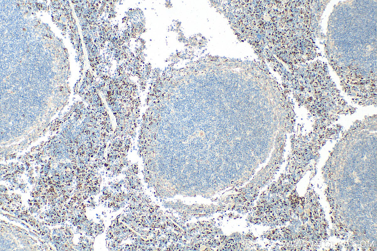 Immunohistochemistry (IHC) staining of mouse spleen tissue using CD206 Polyclonal antibody (32647-1-AP)
