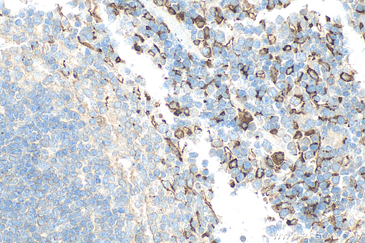 Immunohistochemistry (IHC) staining of mouse spleen tissue using CD206 Polyclonal antibody (32647-1-AP)