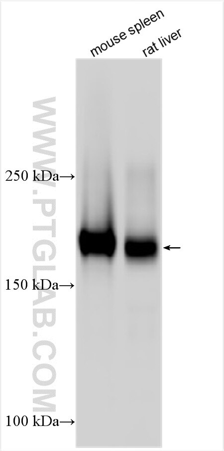 Western Blot (WB) analysis of various lysates using CD206 Polyclonal antibody (32647-1-AP)