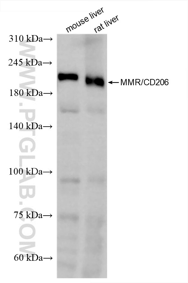 Western Blot (WB) analysis of various lysates using CD206 Recombinant antibody (81525-2-RR)