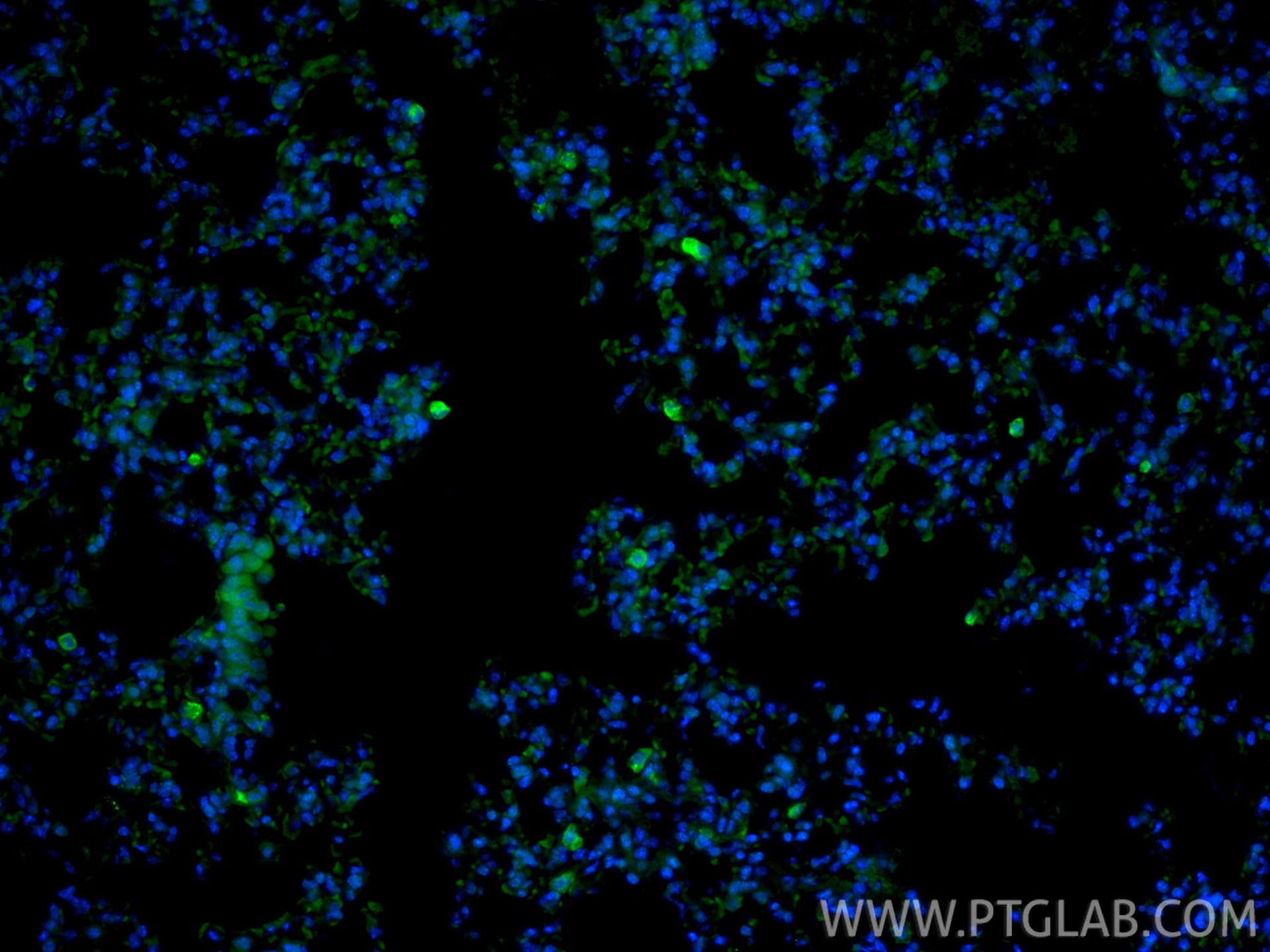 IF Staining of mouse lung using 83485-1-RR Immunofluorescence (IF) / fluorescent staining of mouse lung tissue using CD206 Recombinant monoclonal antibody (83485-1-RR)