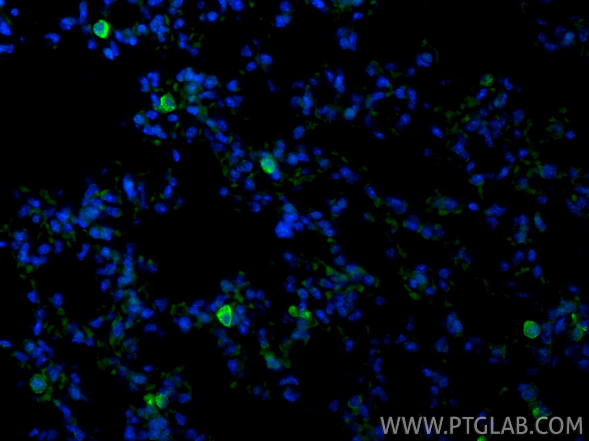 IF Staining of mouse lung using 83485-1-RR Immunofluorescence (IF) / fluorescent staining of mouse lung tissue using CD206 Recombinant monoclonal antibody (83485-1-RR)