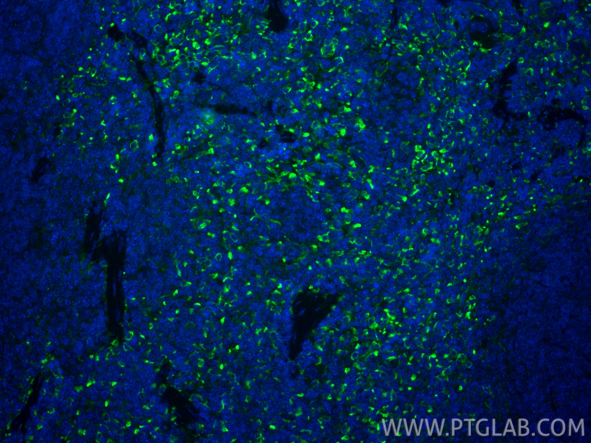 IF Staining of mouse spleen using 83485-1-RR Immunofluorescence (IF) / fluorescent staining of mouse spleen tissue using CD206 Recombinant monoclonal antibody (83485-1-RR)