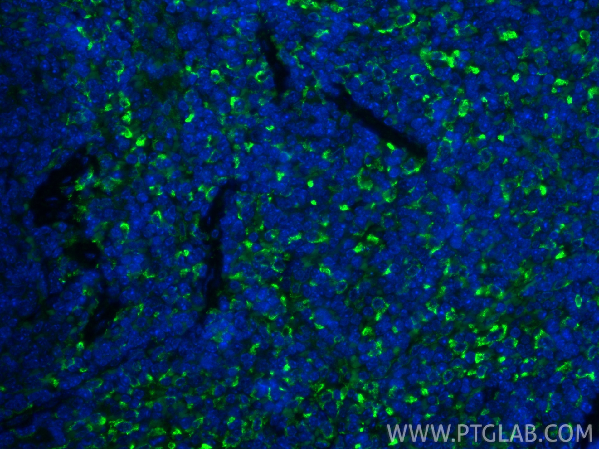 IF Staining of mouse spleen using 83485-1-RR Immunofluorescence (IF) / fluorescent staining of mouse spleen tissue using CD206 Recombinant monoclonal antibody (83485-1-RR)