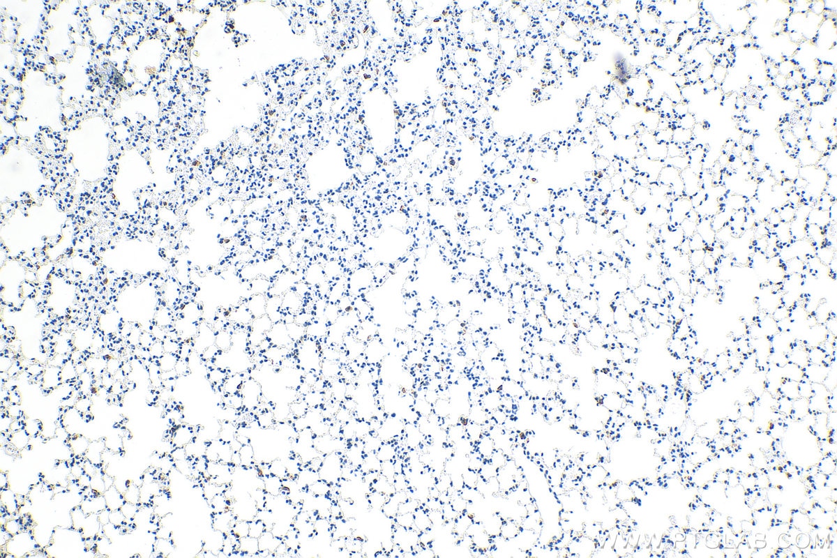 Immunohistochemistry (IHC) staining of mouse lung tissue using CD206 Recombinant antibody (83485-1-RR)