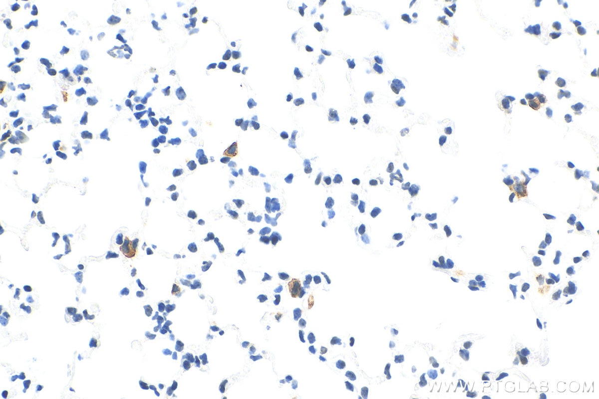 Immunohistochemistry (IHC) staining of mouse lung tissue using CD206 Recombinant antibody (83485-1-RR)