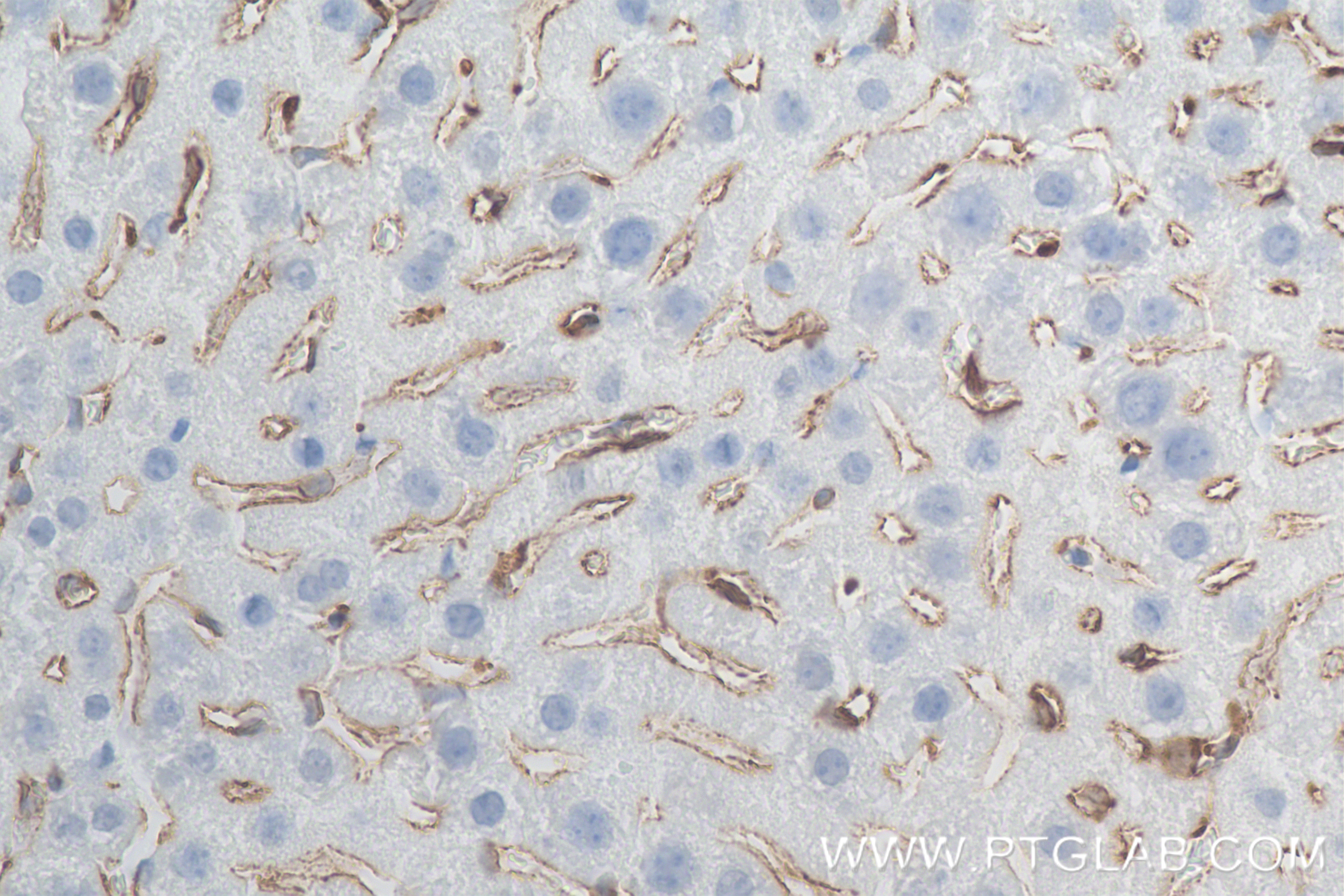IHC staining of mouse liver using 83485-1-RR Immunohistochemistry (IHC) staining of mouse liver tissue using CD206 Recombinant monoclonal antibody (83485-1-RR)