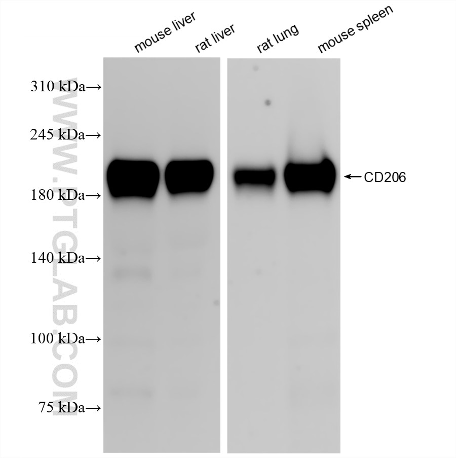 Western Blot (WB) analysis of various lysates using CD206 Recombinant antibody (83485-1-RR)