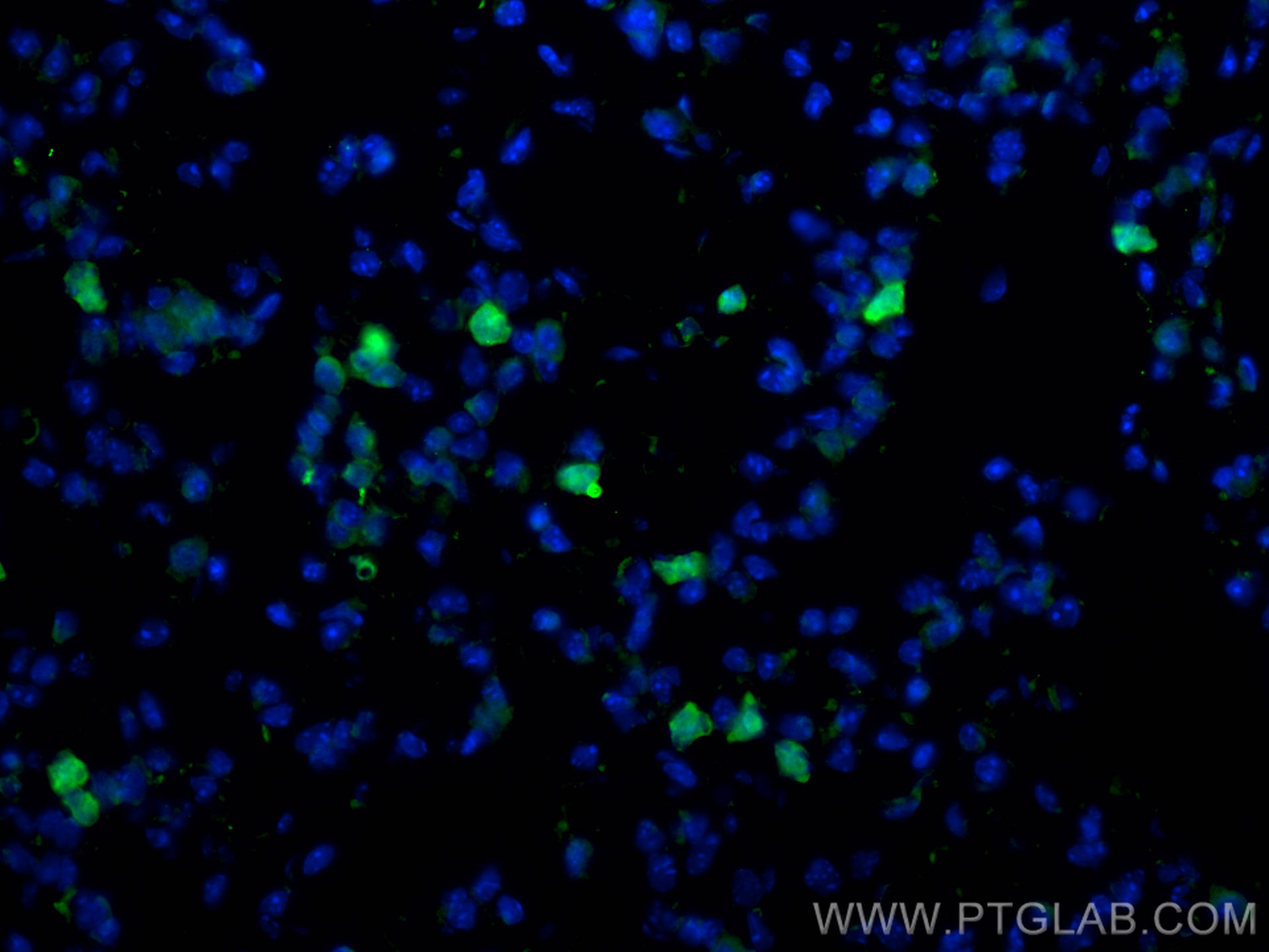 Immunofluorescence (IF) / fluorescent staining of mouse lung tissue using CoraLite® Plus 488-conjugated CD206 Polyclonal ant (CL488-18704)