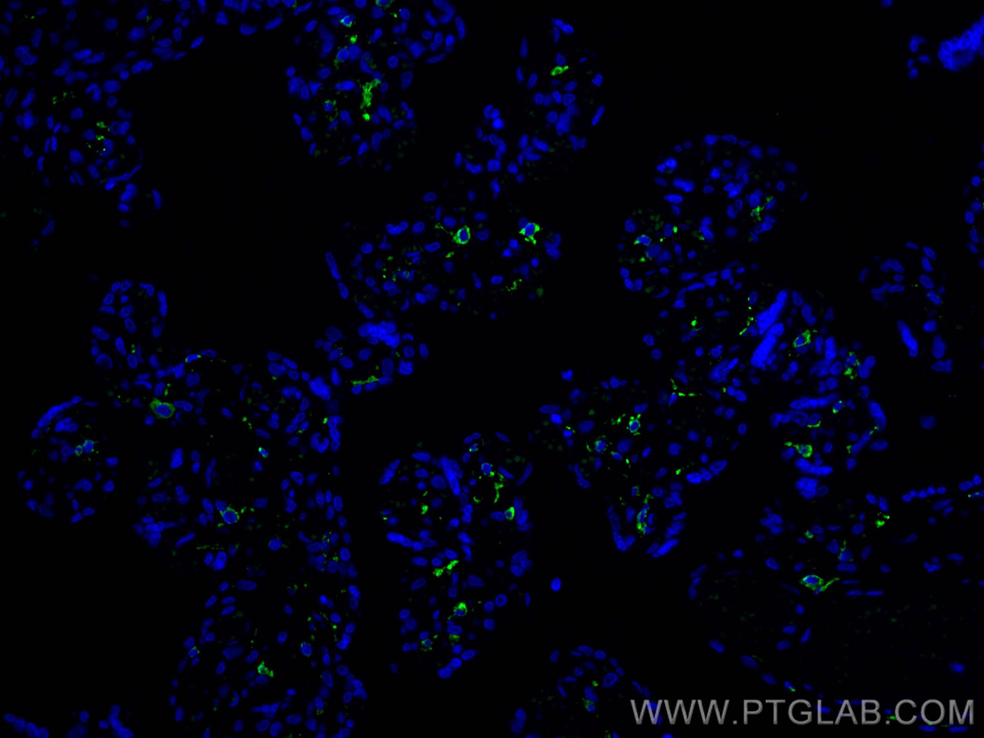 Immunofluorescence (IF) / fluorescent staining of human placenta tissue using CoraLite® Plus 488-conjugated CD206 Recombinant an (CL488-81525)
