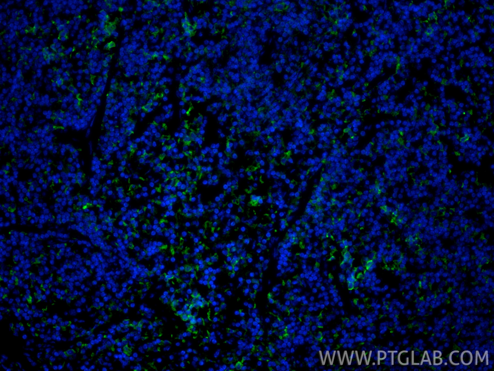 Immunofluorescence (IF) / fluorescent staining of mouse spleen tissue using CoraLite® Plus 488-conjugated CD206 Recombinant mo (CL488-83485)