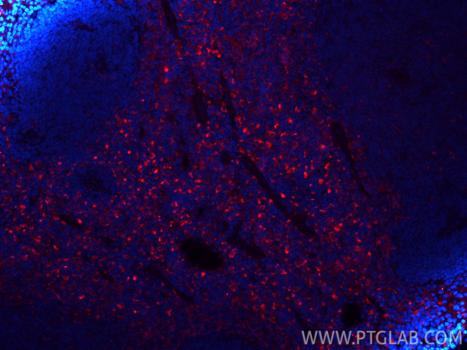 Immunofluorescence (IF) / fluorescent staining of mouse spleen tissue using CoraLite®594-conjugated CD206 Recombinant monoclon (CL594-83485)