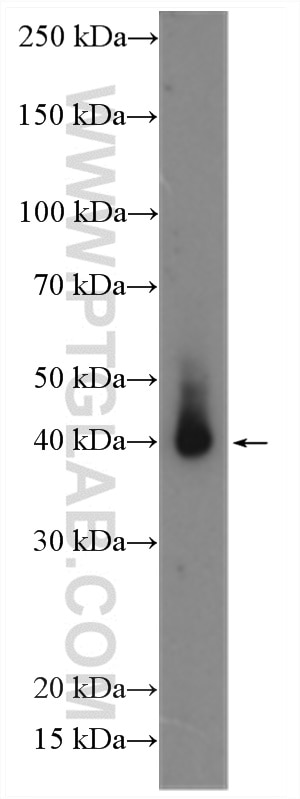 Western Blot (WB) analysis of mouse skin tissue using Langerin Polyclonal antibody (11841-1-AP)