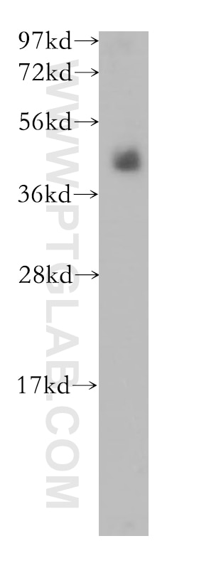 Western Blot (WB) analysis of human skin tissue using Langerin Polyclonal antibody (11841-1-AP)