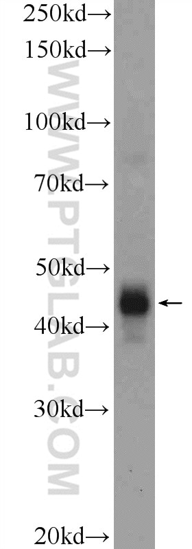 Western Blot (WB) analysis of human placenta tissue using CD209 Polyclonal antibody (25404-1-AP)