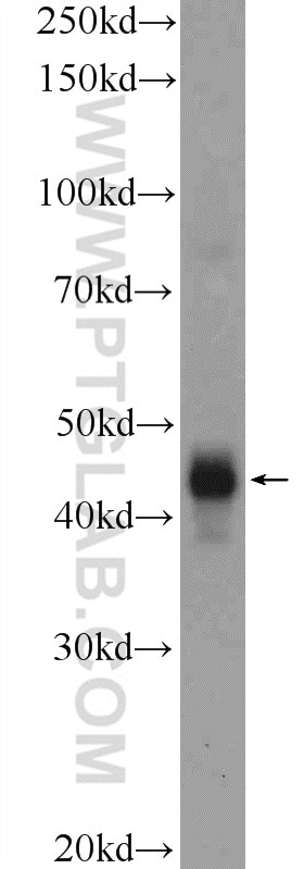 WB analysis of human placenta using 25404-1-AP