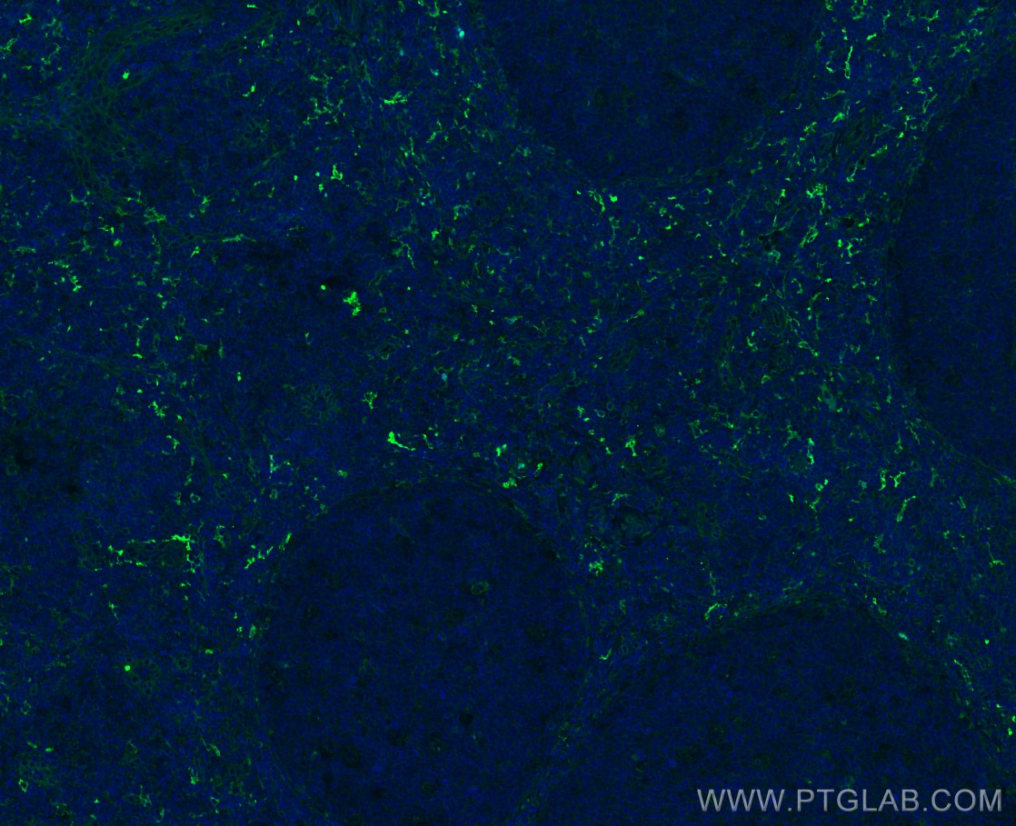 Immunofluorescence (IF) / fluorescent staining of human tonsillitis tissue using CD209 Polyclonal antibody (31621-1-AP)