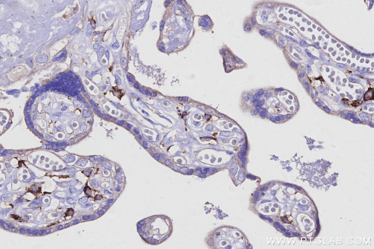 IHC staining of human placenta using 31621-1-AP Immunohistochemistry (IHC) staining of human placenta tissue using CD209 Polyclonal antibody (31621-1-AP)