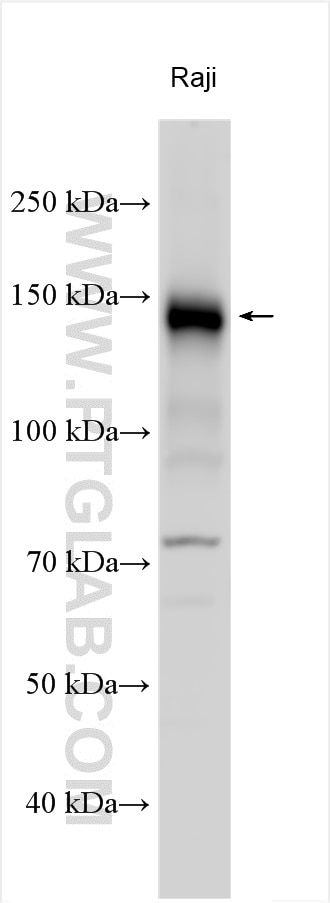 Western Blot (WB) analysis of various lysates using CD21 Polyclonal antibody (24374-1-AP)