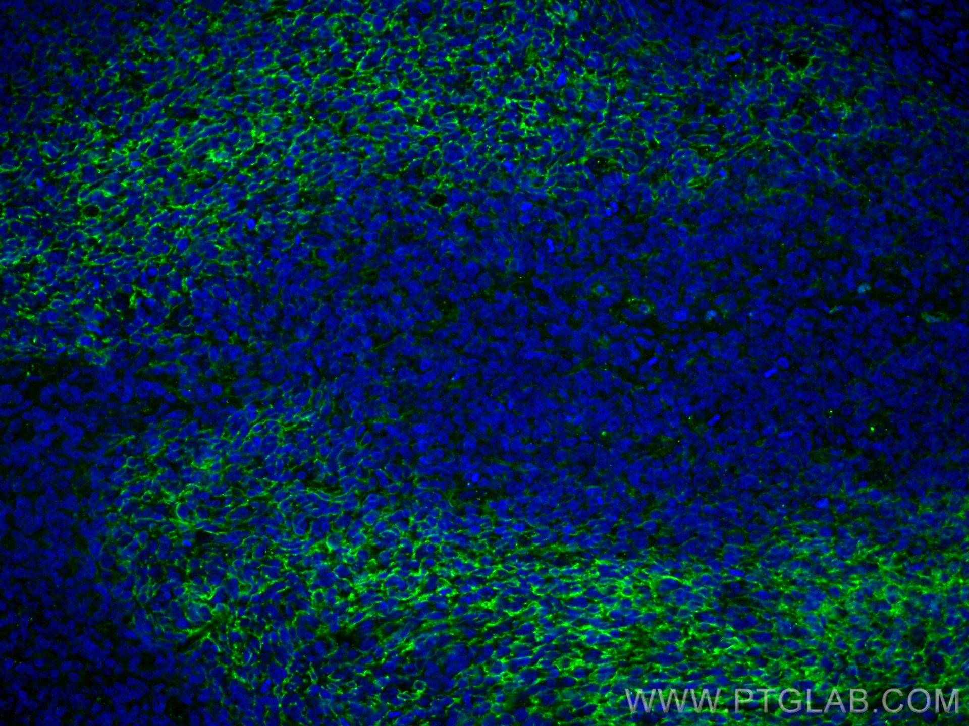 Immunofluorescence (IF) / fluorescent staining of human tonsillitis tissue using CD21 Polyclonal antibody (28206-1-AP)