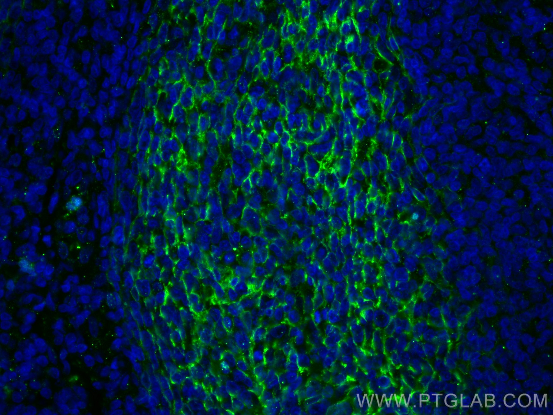 Immunofluorescence (IF) / fluorescent staining of human tonsillitis tissue using CD21 Polyclonal antibody (28206-1-AP)