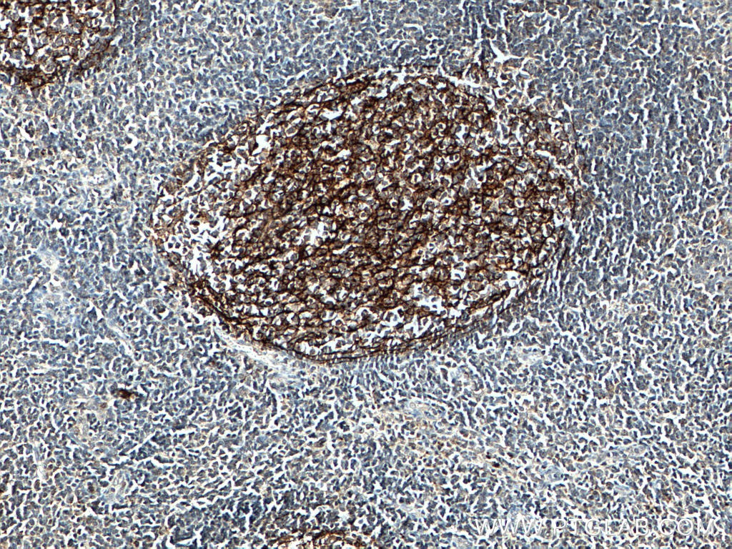 Immunohistochemistry (IHC) staining of human tonsillitis tissue using CD21 Polyclonal antibody (28206-1-AP)