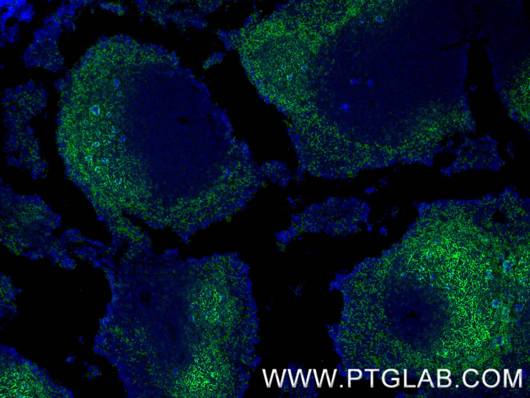 Immunofluorescent analysis of (4% PFA) fixed paraffin-embedded mouse spleen tissue using CD21/CD35 antibody (84565-2-RR, Clone: 241957E6 ) at dilution of 1:400 and CoraLite®488-Conjugated Goat Anti-Rabbit IgG(H+L) (SA00013-2). Heat mediated antigen retrieval with Tris-EDTA buffer (pH 9.0). Immunofluorescence (IF) / fluorescent staining of mouse spleen tissue using CD21/CD35 Recombinant monoclonal antibody (84565-2-RR)