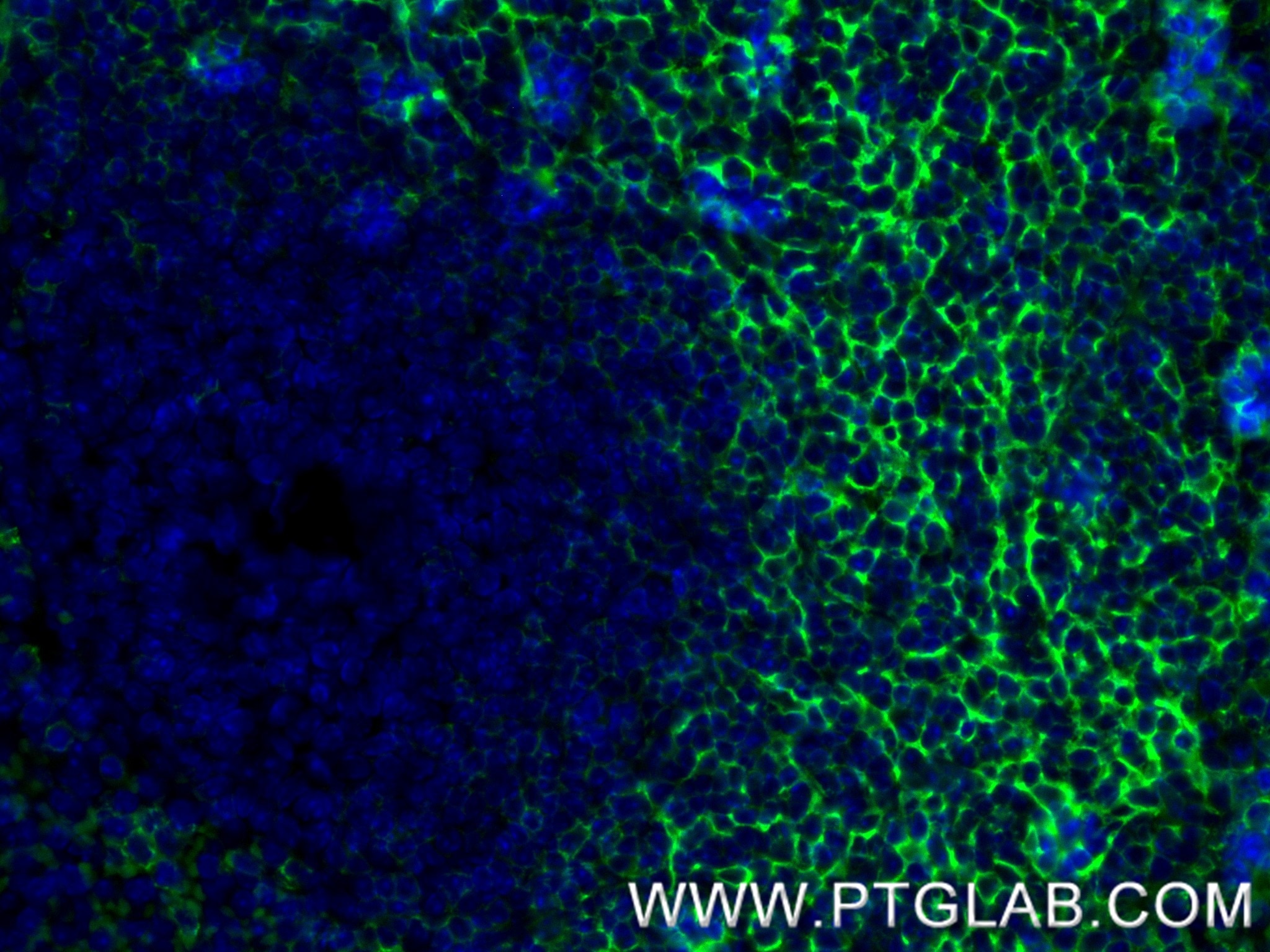 Immunofluorescent analysis of (4% PFA) fixed paraffin-embedded mouse spleen tissue using CD21/CD35 antibody (84565-2-RR, Clone: 241957E6 ) at dilution of 1:400 and CoraLite®488-Conjugated Goat Anti-Rabbit IgG(H+L) (SA00013-2). Heat mediated antigen retrieval with Tris-EDTA buffer (pH 9.0). Immunofluorescence (IF) / fluorescent staining of mouse spleen tissue using CD21/CD35 Recombinant monoclonal antibody (84565-2-RR)