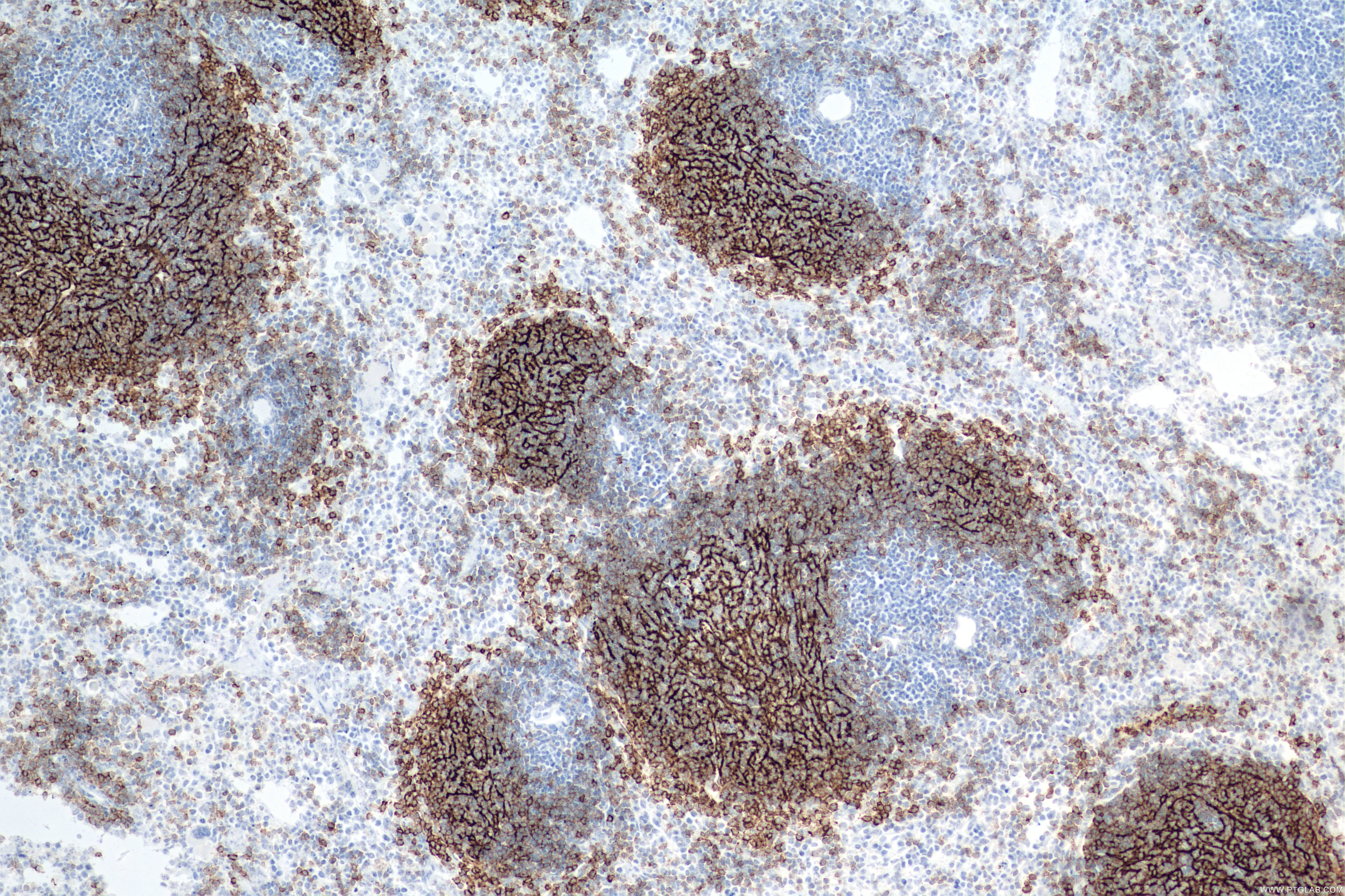 Immunohistochemistry (IHC) staining of mouse spleen tissue using CD21/CD35 Recombinant antibody (84565-2-RR)